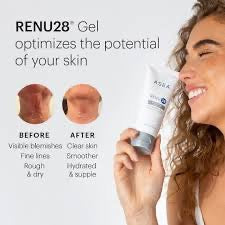 Renui28 Redox-Gel – Revitalisieren Sie Ihre Haut!